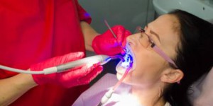 Acasa 9 Chirurgie orala